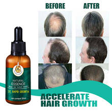 Esencia para el crecimiento del cabello, tratamiento de reparación del cabello, aceite esencial líquido para el crecimiento del cabello, suero para prevenir la pérdida de cabello, restauración rápida 2024 - compra barato