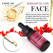 100% Pure Organic Rosehip Oil for Scars Fine Lines Anti-Aging Wrinkle Stretch Marks Dehydrated Skin Whitening Moisturizer 2024 - buy cheap