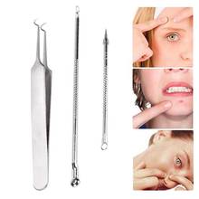 3pcs Face Care Tool Acne Removal Needle Tweezers Black Head Pimples Removal Blackhead Acne Extractor Spot Cleaner Skin Care Tool 2024 - buy cheap