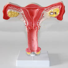 Modelo anatómico ovario uterino de OBSTETRICIA Y GINECOLOGIA 2024 - compra barato