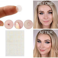 36PCS Acne Treatment Pads Patch Treatment of Acne Skin Face Available Sanitary Convenient Sticker Plaster Blemish Acne Remover 2024 - buy cheap