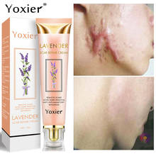 Yoxier-Crema para eliminar cicatrices y acné, Gel para el cuidado de la piel, tratamiento de acné, puntos negros, blanqueamiento suave 2024 - compra barato