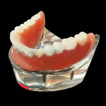 1 шт. Стоматологическая 4 имплантата модель исследования зубов Overdenture Нижняя демонстрационная модель 2024 - купить недорого