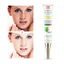 Effective Whitening Freckle Cream Remove Melasma Acne Spot Pigment Melanin Dark Spots Soothing Moisturizing Gel Skin Care 2024 - buy cheap