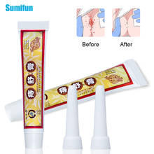 1/3/5 pcs Chinese Herbal Hemorrhoids Ointment Crack Anal Internal & External Anal Fissure Painkiller Cream Balm Medical Plaster 2024 - buy cheap