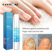 LANTHOME Nail Treatment Essence Liquid Nail and Foot Whitening Toe Nail Fungus Removal Feet Care Nail Gel Makeup Set Cuticle Oil 2024 - buy cheap