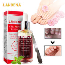 LANBENA Nail Repair Essence Serum Fungal Nail Treatment Remove Onychomycosis Toe Nourishing Brighten Hand Foot Skin Care 12ml 2024 - buy cheap