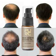 Gran oferta de aceite esencial para el crecimiento rápido del cabello para el tratamiento de la pérdida de cabello ayuda para el crecimiento del cabello 20ml 2024 - compra barato