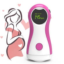 BOXYM-Doppler Fetal Prenatal para mujeres embarazadas, Monitor de ritmo cardíaco Fetal portátil, con auricular gratis 2024 - compra barato