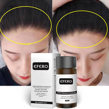 Óleo de crescimento capilar, essência natural de gengibre para crescimento capilar, tratamento anti perda, cabelo denso, restauração 2024 - compre barato