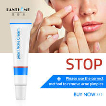 Lanthome Pearl Anti Mite Cream Face Acne Treatment Skin Care Acne Scars Cream Anti Acne Remove Moisturizing Deep Clear Cream 2024 - buy cheap