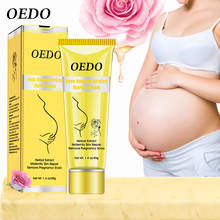 Rose Remove Stretch Marks Cream Anti Wrinkle Anti Aging Maternity Skin Repair Remove Pregnancy Scars Treatment Body Skin Care 2024 - buy cheap