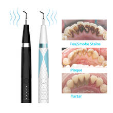 Raspador dental ultrassônico doméstico com luz led, limpador de tártaro e manchas, ferramentas de higiene oral 2024 - compre barato