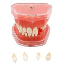 Dental macio gum modelo padrão com todos os dentes removíveis #4004 01 dental estudo ensino dente modelo 28 pces dente dentista laboratório 2024 - compre barato