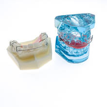 Dental Functional Orthopedic wiht Retainer Model Teeth Model Dental Teach Study 2024 - buy cheap