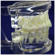 CMAM/12602 Dental- celar Children dentition, Human Oral Dental Medical Teaching Anatomical Model 2022 - buy cheap