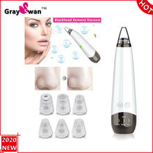 Blackhead Remover Vacuum Face Deep Cleaner Pore Acne Pimple Removal Suction Facial Diamond Beauty Blackhead Cleaner Tool 2024 - buy cheap