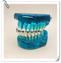 Modelo de dentes ortodônticos, com suporte de metal/dentes para cuidado oral, modelo m3003 com suporte de cerâmica 2024 - compre barato