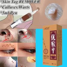 Skin Tag Remover Pen 12 Hours Tu kill Medical Tu kill Remover Skin Tag Mole & Genital Wart Remover Foot Corn Removal Skin Care 2024 - buy cheap