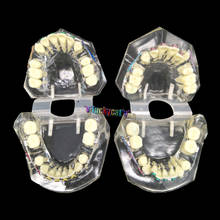1 шт. зубная, Ортодонтическая модель с красочными кронштейнами модели неправильного прикуса обучающая модель Стоматологический материал инструменты для стоматолога 2024 - купить недорого