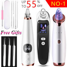 Blackhead Remover Vacuum Cleaner Acne Needle Tweezer Black Head Extractor Pore Pimple Nose Suction Massager Facial Removal Tools 2024 - buy cheap