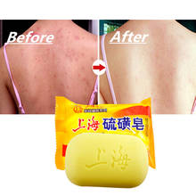 1pcs Shanghai Sulfur Soap Oil-control Acne Treatment Blackhead Remover Soap Whitening Cleanser Chinese Traditional Skin Care 85g 2024 - buy cheap
