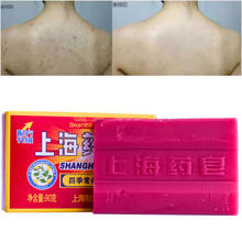 Anti-mites Anti-acne Shanghai Medicinal Soap  Body Cleansing Soap Skin Treatment Acne Psoriasis Seborrhea Eczema Anti Fungus 2024 - compre barato