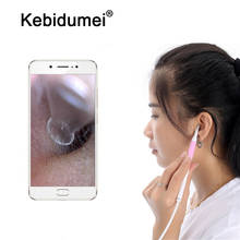 kebidumei Medical Otoscope 3 in 1 Wifi Ear Cleaning Otoscope Integrated 5.5mm Ear Pick Tool Visual Ear Spoon Camera Endoscope 2024 - buy cheap