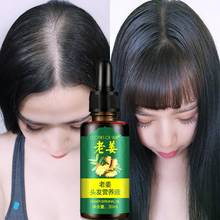 30ML Effective Ginger Hair Growth Ointment Hair Care Healthy Anti-Hair Loss Essence Oil Damaged Hair Nutrition Cream TSLM1 2024 - buy cheap