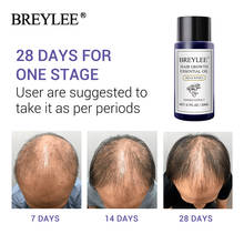 BREYLEE эфирное масло для роста волос быстро мощные Продукты для волос уход за волосами предотвращает облысение против выпадения волос сыворотка питательная 20 мл 2024 - купить недорого