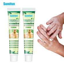 Sumifun creme de manchas brancas, creme de treinamento de vitiligo, psoríase antibacteriano, pomada localizada, micose, leukopláxia, gesso, peças 2024 - compre barato