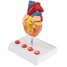 Modelo de corazón humano, 1:1, 2 partes, médico con 4 etapas Trombo de modelo de corazón, modelos de demostración de laboratorio 2024 - compra barato