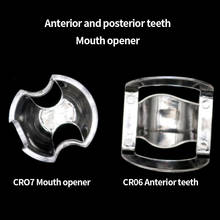 5Pcs Dental Mouth Opener Autoclavable Lip Retractor Cheek Expander For Anterior/Posterior Teeth 2024 - buy cheap