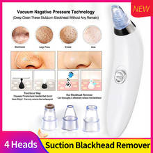 4 Suction Heads Blackhead Remover Vacuum Pore Cleaner Acne Blackhead Facial Removal Suction Machine Skin Care Tool Face Cleaning 2024 - buy cheap