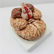 Modelo de cérebro de tamanho humano, modelo anatômico preciso de cérebro, modelo de 9 partes de dispositivo arterial cérebro para ciências, salas de aula, display de estudo 2024 - compre barato