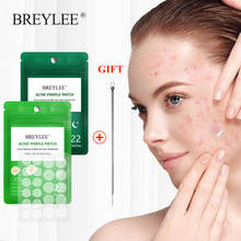 Breylee máscara facial com adesivo de acne e espinhas, máscara de tratamento com agulha para cuidados com a pele em creme preto com 1 peça 2024 - compre barato
