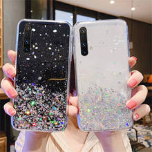 Luxury Glitter Star Case For Huawei P20 P30 Pro Case Honor 8 9 Lite P8 2017 10 20 10i 20i 8X 8C 8A 7X V20 V30 Silicone Cover 2024 - buy cheap
