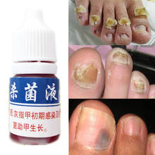 Fungal Nail Treatment Liquid Foot Care Essence Whitening Toe Nail Fungus Removal Gel Anti Infection Paronychia Onychomycosis 2024 - buy cheap