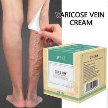 Crema para venas varicosas, pomada médica para tratamiento de venas varicosas, medicina Herbal china 2024 - compra barato