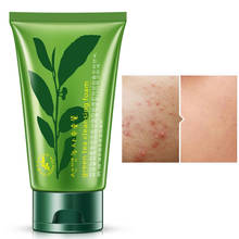 Green Tea Serum Moisturizing Facial Cleanser Oil Control Pore Washing  Face Skin Care Anti Aging Wrinkle treatment 100g 2024 - buy cheap