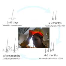Casco con luz infrarroja LED para hombres y mujeres, gorra para el crecimiento rápido del cabello, solución para la pérdida de cabello, tratamiento láser 2024 - compra barato