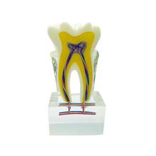Teeth Model 6 Times Tooth Model with Nerves Dental Model Demonstration Model Dentistry Products 2024 - buy cheap