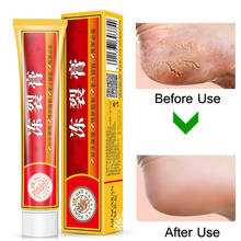 Powerful Hand Foot Crack Cream Heel Chapped Peeling Foot and Hand Repair Heeling Cream Anti Chapping Wrinkle Treatment Skin Care 2024 - buy cheap