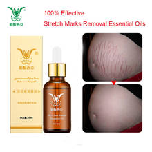 Stretch Marks Removal Essential Oils Pure Natural Stretch Marks Remover Obesity Postpartum Anti-wrinkle Repair Cream  Skin Care 2024 - buy cheap