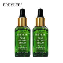 BREYLEE 2PCS Acne Treatment Serum Natural Facial Essence Acne Scar Removal Face Skin Care Whitening Repairing Pimples Remover 2024 - buy cheap