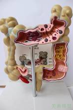 1/2 Life Size Human Rectal Pathology Colon Model Large Intestine Model Anorectal Anatomical Model Tools 2024 - buy cheap