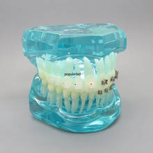 Стоматологическая Ортодонтическая модель 4 типа скобок коммуникационная Модель Стоматологическая модель для зубов 2024 - купить недорого