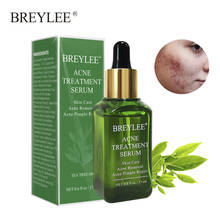 Acne Treatment Serum Facial Essence Anti Acne Scar Removal Cream Face Skin Care Whitening Repair Pimple Remover For Acne 2024 - buy cheap