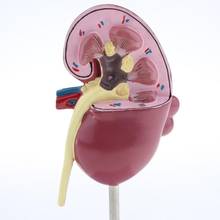 Órgano médico para el riñón, modelo anatómico para lesiones, suministros para la salud humana 2024 - compra barato