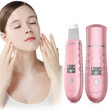 CkeyiN-Depurador de piel con ultrasonido, limpieza profunda de cara, eliminador de espinillas, tratamiento de acné, masaje de belleza antiarrugas 2024 - compra barato